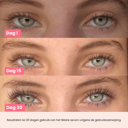 Nilaire voor en na – dag 1 en dag 30